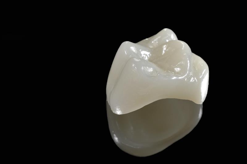 All Porcelain Dental Crowns in Ontario, CA Smile Connection